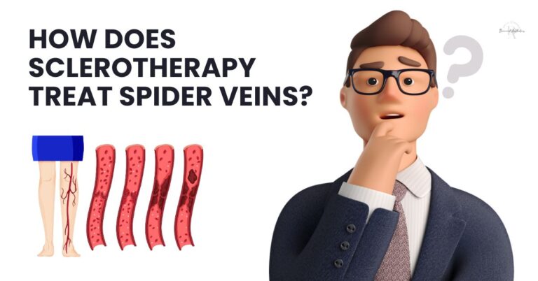 How does sclerotherapy treat spider veins