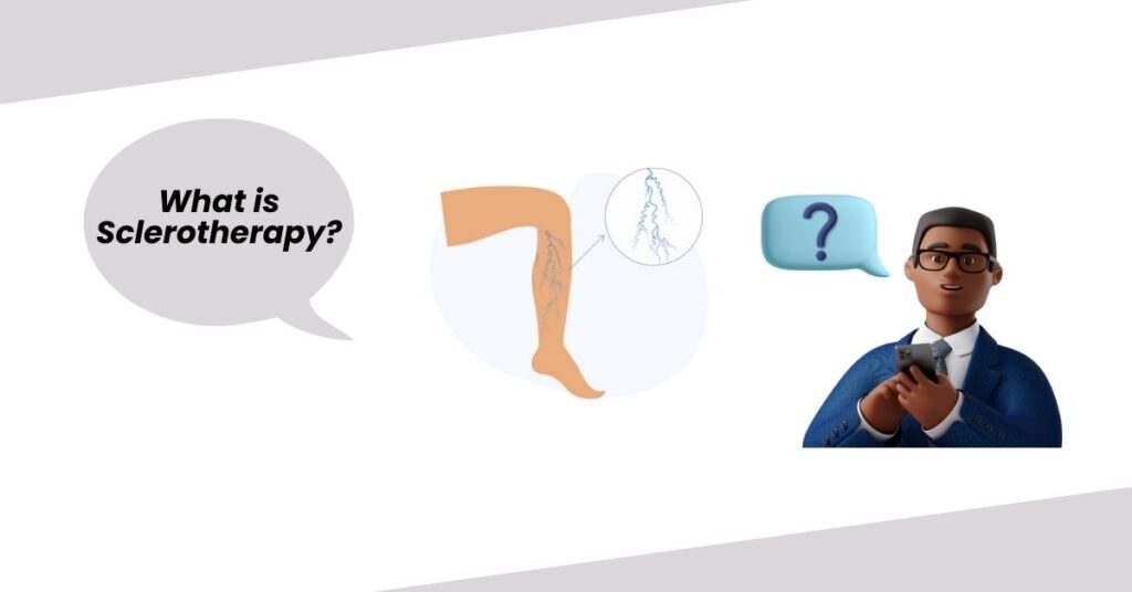 What is Sclerotherapy