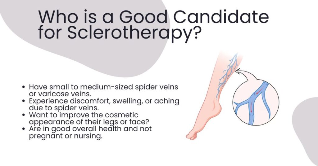 Who is a Good Candidate for Sclerotherapy