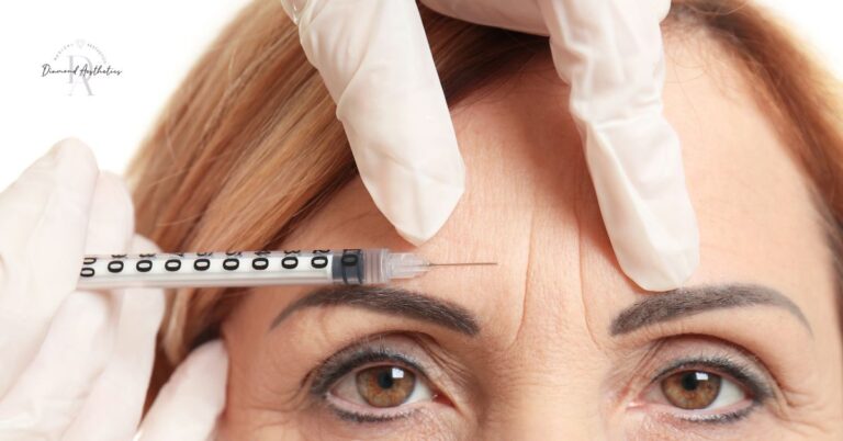 What Are Botox Injections