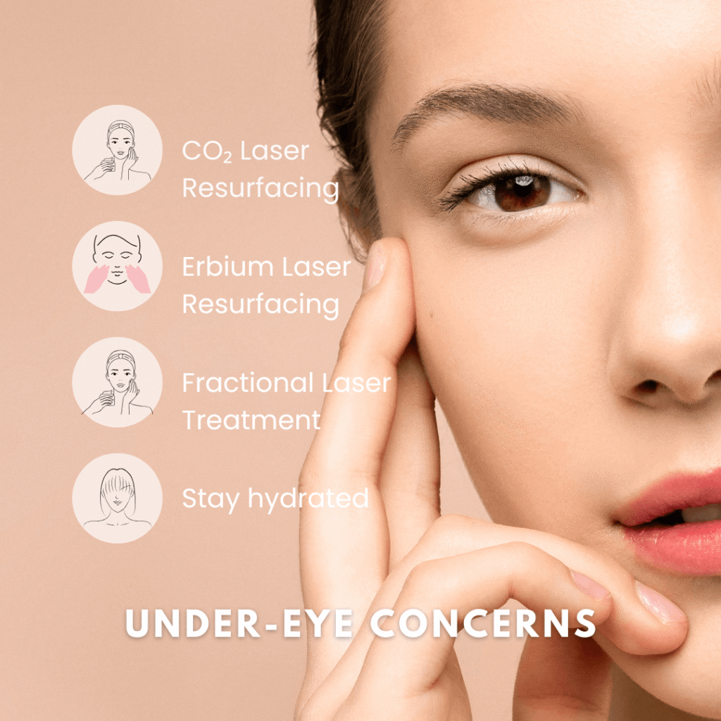 Types of Laser Treatments for Under-Eye Concerns