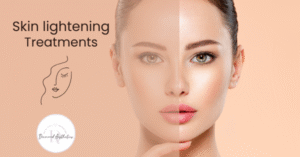Skin Lightening Treatments