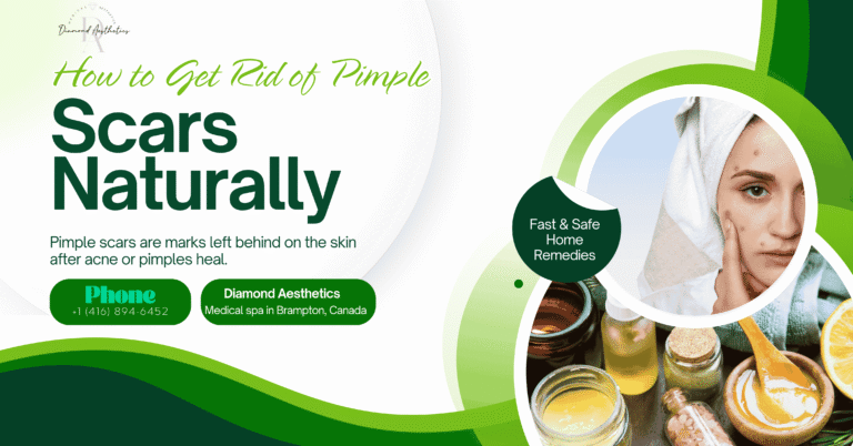 How to Get Rid of Pimple Scars Overnight Naturally Fast & Safe Home Remedies