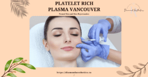 Platelet Rich Plasma Vancouver