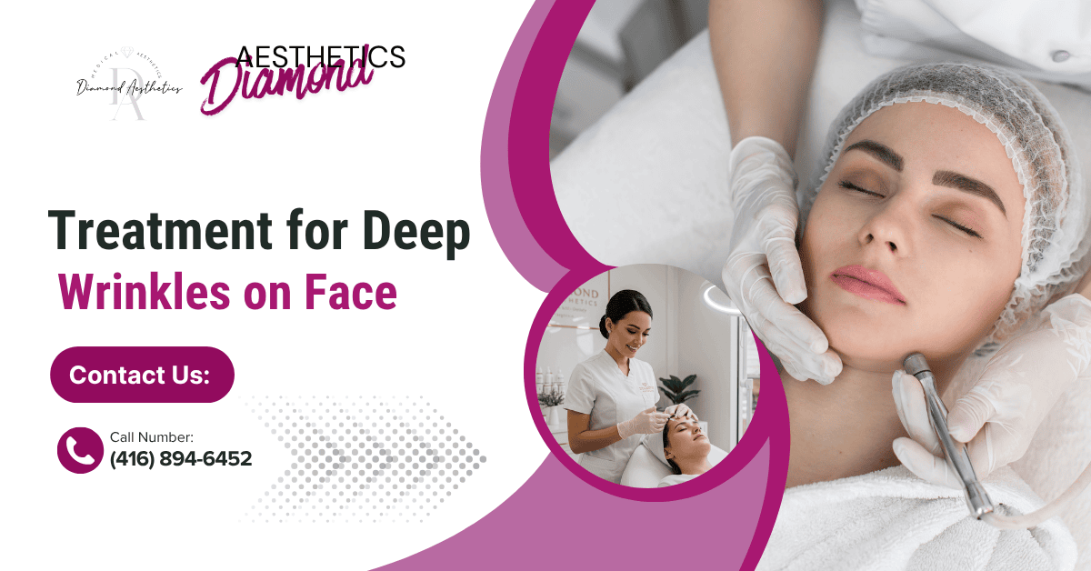 Best Treatment for Deep Wrinkles on Face – Botox, Fillers & Skincare Backed by Science 1 Aesthetic injector performing professional wrinkle treatment in a Diamond Aesthetics clinic